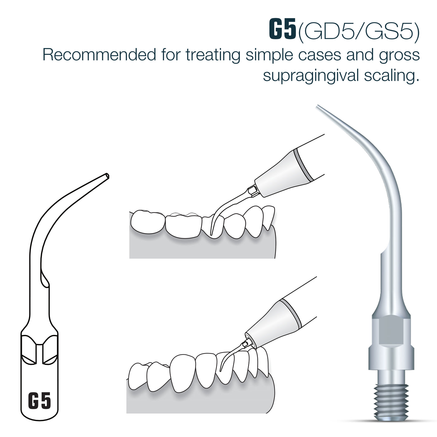 Woodpecker SIRONA Compatible Scaler Tips GS5