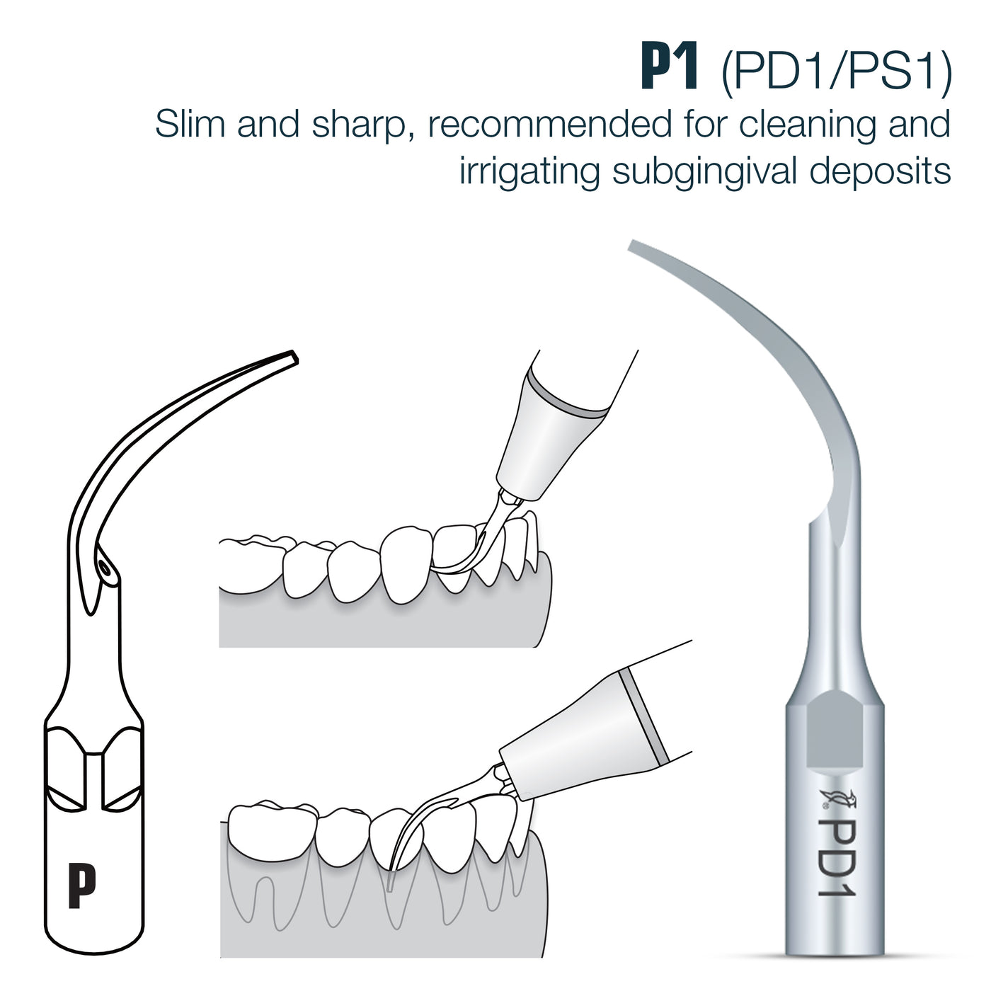 Perio Scaler Tips DTE/ SATELEC Compatible (PD) (9613327499539)