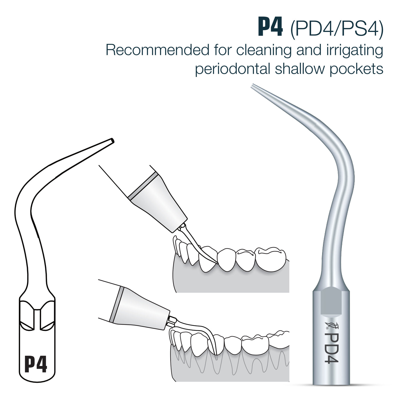 Perio Scaler Tips DTE/ SATELEC Compatible (PD) (9613327499539)