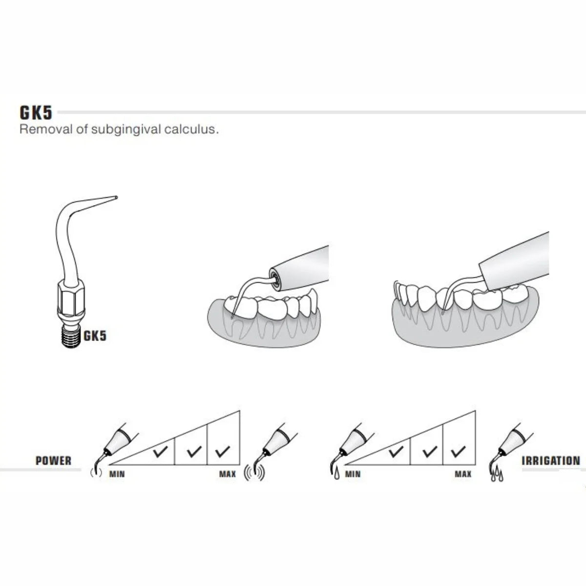 Woodpecker Kavo Compatible Scaler Tips GK5