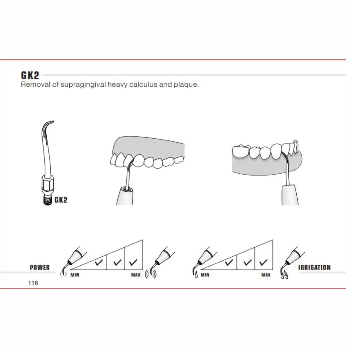 Woodpecker Kavo Compatible Scaler Tips GK2