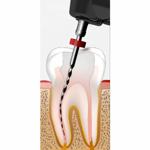 Woodpecker Endomatic Endo Motor with Apex Locator