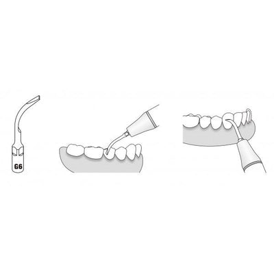 Scaler Tips EMS / Woodpecker Compatible G6 - VSDent (4119997055075) (9027003482387)