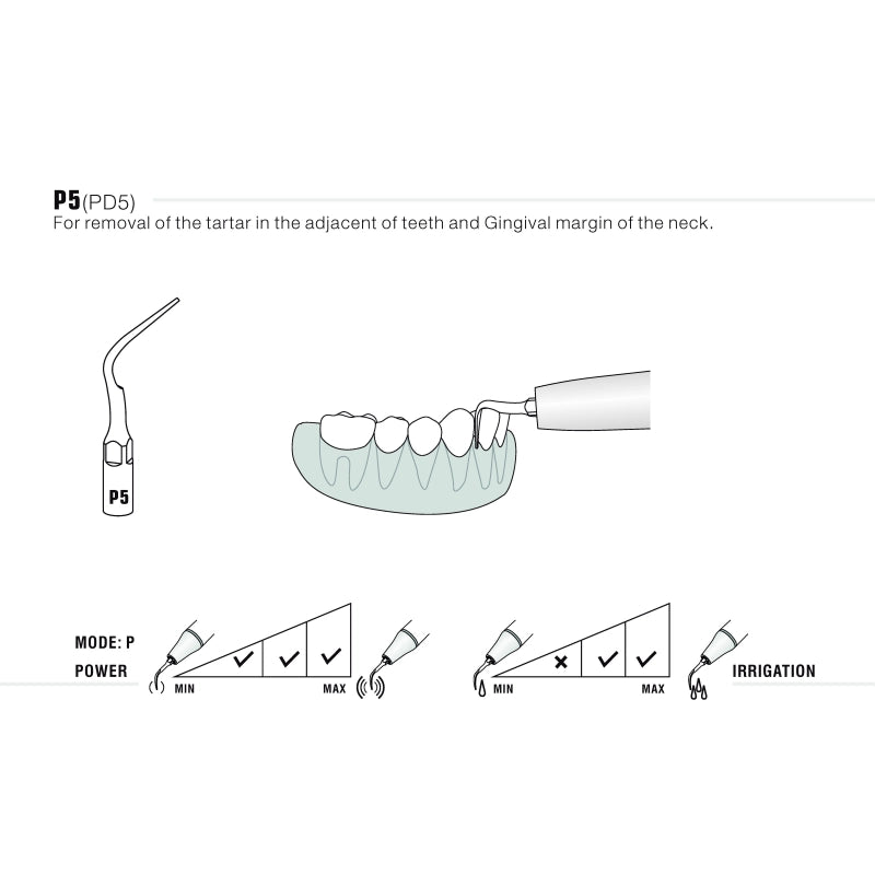 EMS/Woodpecker Compatible Scaler Tips P5